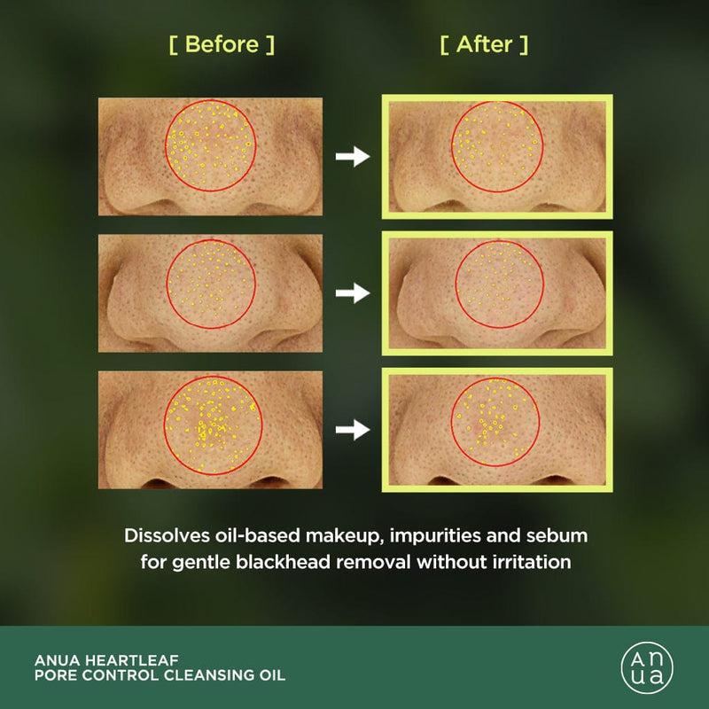 Anua Heartleaf Cleansing Oil 200ml – Deep Pore Cleanser & Blackhead Removal